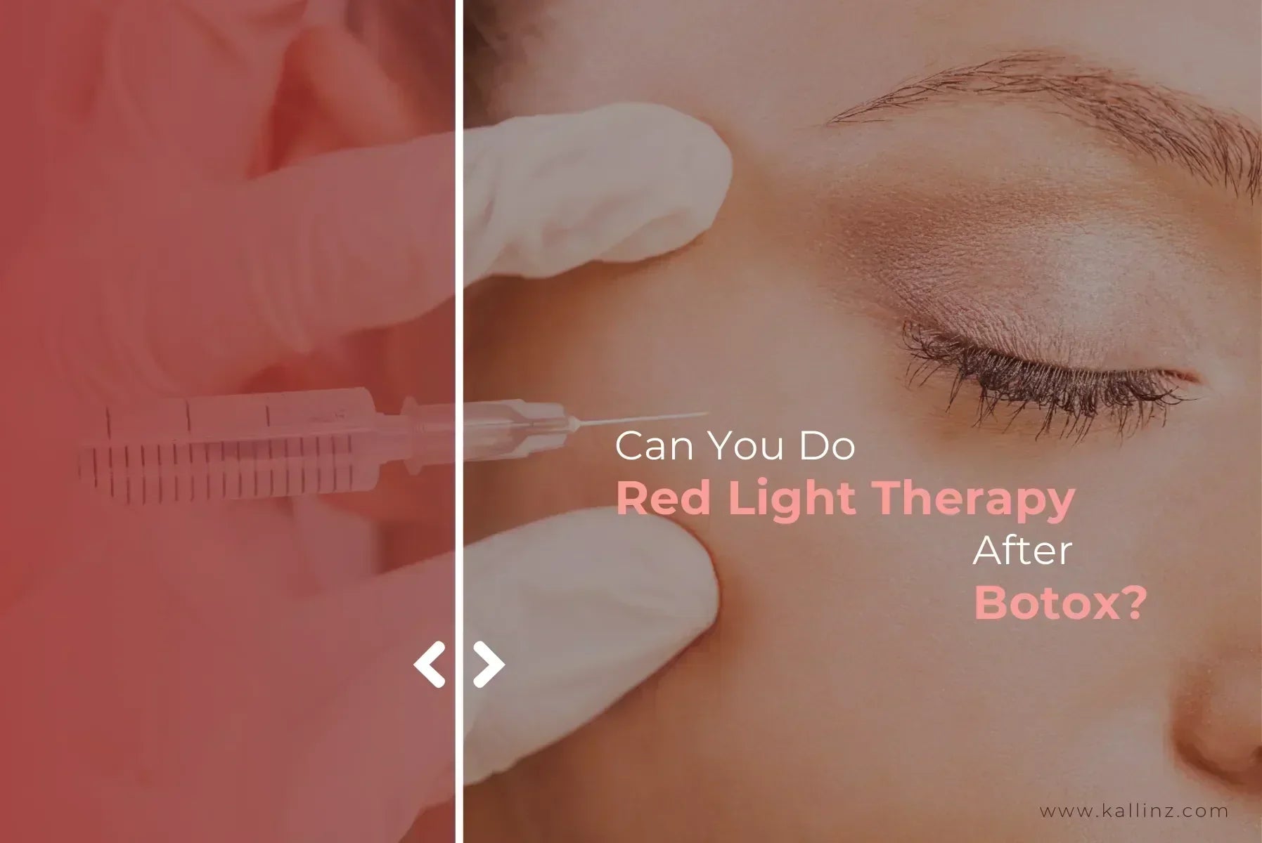Botox Red Can You Do Red Light Therapy After Botox? – Kallinz