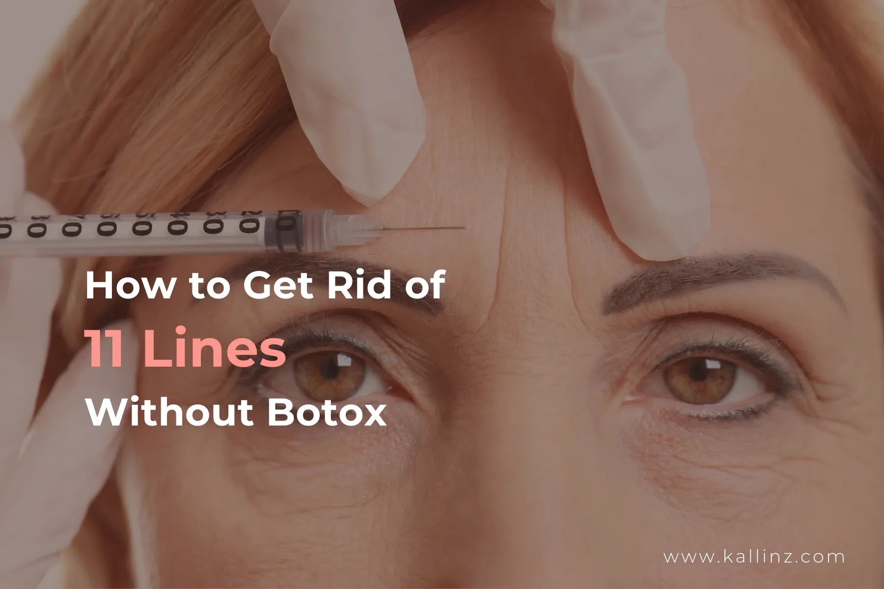 How to Get Rid of Eleven Lines Without Botox cover