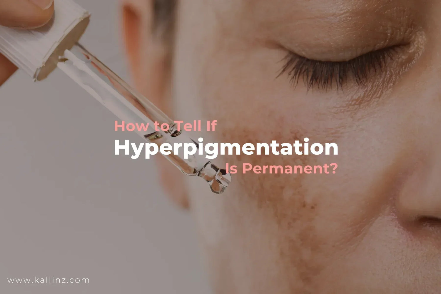 How to Tell If Hyperpigmentation Is Permanent Blog cover