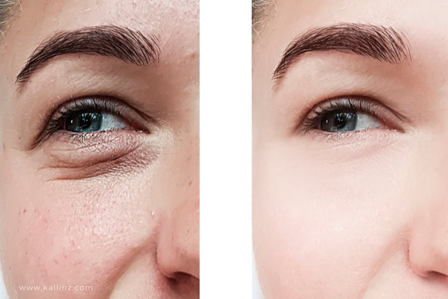 Comparing Anti-Aging Treatments